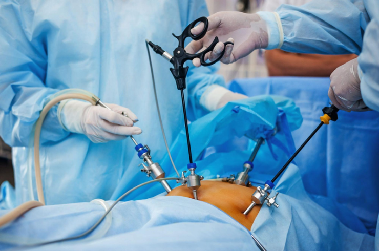 Hernia Surgery